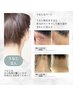 【新規】結果重視の美肌脱毛◎Sパーツ1回￥4400→