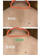 ひまわり 久屋店/筋膜リリースマッサージ