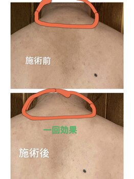 ひまわり 久屋店/筋膜リリースマッサージ