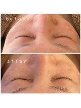 メナードフェイシャルサロン 岐阜茜部/モイストプールパック