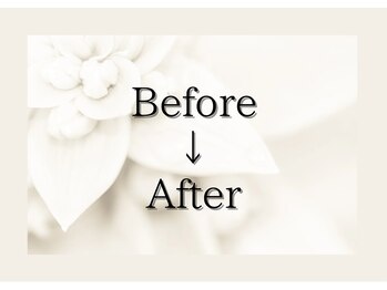 アルゴ 春日那珂川店(ALGO)/脱毛のビフォアフターご紹介♪