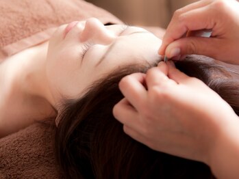 おれんじ鍼灸院/施術風景