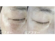 サロンドミジュ(Salon de 美jyu)/プラチナ肌質改善