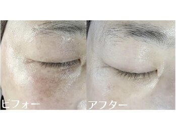 サロンドミジュ(Salon de 美jyu)/プラチナ肌質改善