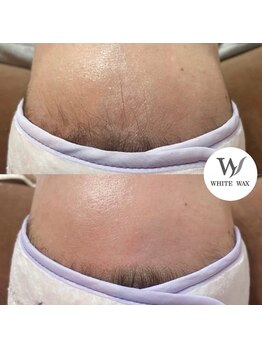 ホワイトワックス 浜松(WHITE WAX)/ワックスでお肌のクレンジング