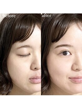 アイリー(IRIE)/HBL＋LASH LIFT