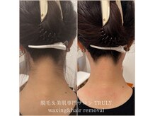 トゥルーリー(TRULY)の雰囲気（自分では見えないうなじのお手入れはプロにお任せ！）