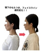 ラボーテヴェリテ(La Beaute Verite)/【お客様施術例】