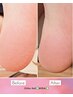【フット】ちゅるるんフット角質ケア（マッサージ→フットバス→角質ケア）