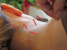 鍼灸整骨院わか/