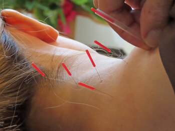 鍼灸整骨院わか/