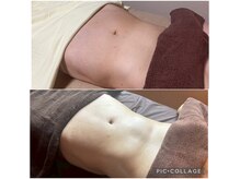 No.3(three)の雰囲気(腸もみの結果です。上が初回、下が2回目むくみも取れてスッキリ)