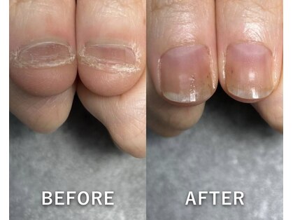 ケーネイル(K.nail)の写真