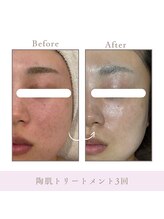 サロン アンジュ(salon.anju)/