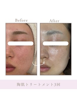 サロン アンジュ(salon.anju)/