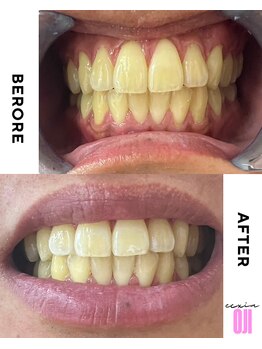 エクシアホワイトニング 王寺店/