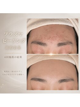 エンフィール(&.Feel)の写真/【肌トラブル・シミケアに◎】親切丁寧な接客と高い技術が自慢!納得いくハイクオリティな仕上がり☆