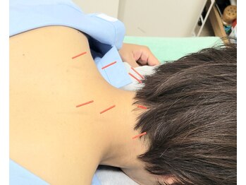 ひのき堂鍼灸治療院の写真/お悩みを根本改善したい方へ!鍼灸が本来の治癒力を引き出す☆心身のバランスが整うオーダーメイドの施術♪