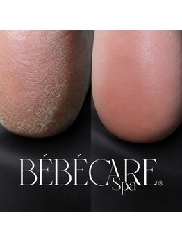 Nail salon juno【11/10 NEW OPEN（予定）】の写真/SNSで話題のBEBE CARE spa導入！角質を優しくケアして、思わず触れたくなるつるつるかかとに。
