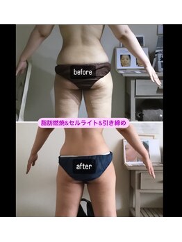 新百合ケ丘の痩身専門エステサロン リリバ(ririva)/下半身セルライト改善引き締め