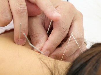 れんげ鍼灸整骨院の写真/【歴24年延べ2万人以上の施術】全身調整鍼で腰痛やお体の慢性的なお悩みを根本改善!!骨盤矯正メニューも◎