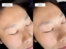 エムドット(m.)/アイブロウワックス脱毛