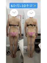 メリアミーゴ(Meli amigo)/60代　痩身ダイエット