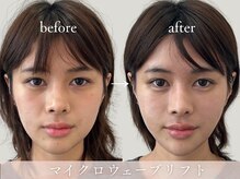 ヤエシーファイブクリニック(YAE C5 CLINIC)の雰囲気（札幌/大通/桑園/フェイシャル/毛穴/ララピール/小顔）