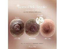 ノワール ブラン(Noir blanc)の雰囲気（1回の施術でここまで変わります！！今なら10000円OFF◇）