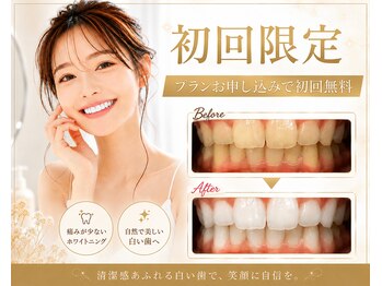 ヌールホワイト 御徒町店(NOOR WHITE)の写真/《6月NEWOPEN》初めての方も安心♪丁寧なカウンセリングで、お悩みや理想に合わせた最適なプランをご提案＊