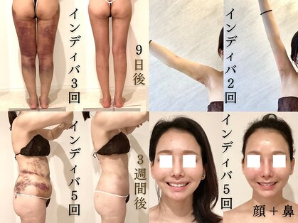 アラマンダ(Allamanda)の写真
