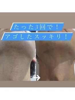 ダイアナ 出雲店(Daiana)/あごしたスッキリ