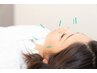 【全身美容】美容・美顔鍼+耳つぼシール鍼　約70分　¥9,000→¥8,000