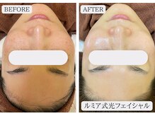 ルミア 函館店(LuMia)/シミ・エイジングケアにはコレ★