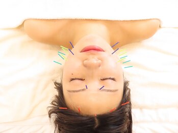 ハリランス(HARILANCE)の写真/年齢と共に気になるホウレイ線やたるみ改善に◎美容鍼×小顔矯正で本格リフトアップ!!若々しい見た目に♪