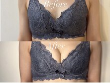 アンシャンテ(ENCHANTER)/光バストアップ