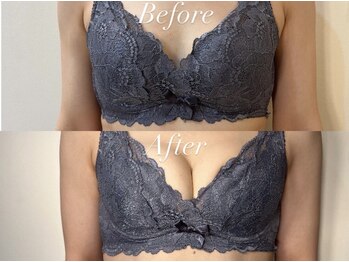 アンシャンテ(ENCHANTER)/光バストアップ