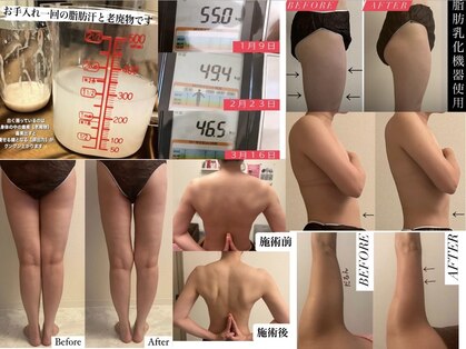 フェミニー(Feminy)の写真