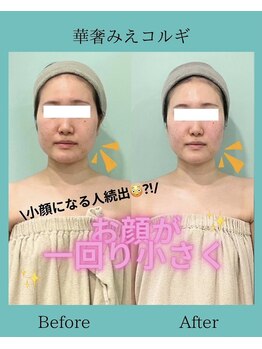 アコガレコガオ 鳥取店/コルギのビフォーアフター