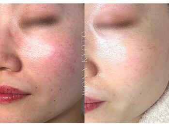 ウォナ(WONA)/【お客様症例】