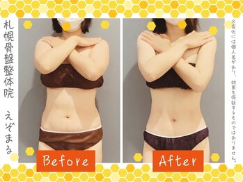 エゾマル(Ezo-maru)/【施術例】ビフォーアフター