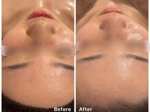 サロンアルーナ(Salon a Luna)/艶肌Wax