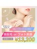 ★期間限定★【 光フェイシャルor顔脱毛】　照射のみ　３回コース　￥13,200