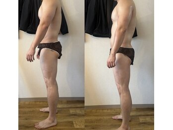 サロン マイワン(Salon MyONE)/姿勢改善ビフォーアフター