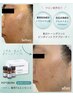 【OPEN記念☆水光美白肌】白玉フェイシャルで透明感アップ↑＋炭酸ヘッドスパ