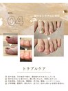 トラブルケア