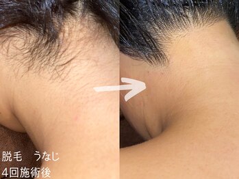 ルーナジェーナ(Luna llena)/池袋　エステ　ルーナジェーナ