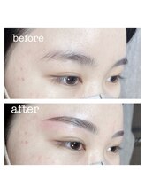 ルルゴ(LULUGO)/ハリウッドブロウリフト