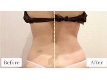 アルメリア(Armeria)/腰回り【結果写真】