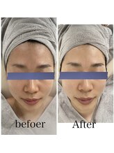 リッチベル(richbelle)/ハイドロスプラッシュ